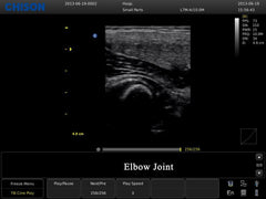 Chison ECO3 Expert Ultrasound For Sale