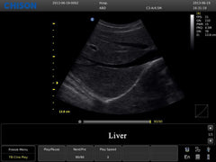 Chison ECO3 Expert Ultrasound For Sale