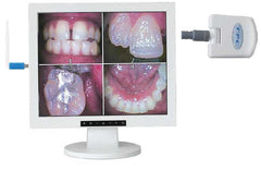 AIC2IN1W 17" Flat Screen Monitor Multi-Media w/AIC5855A Intra-oral Camera Pkg