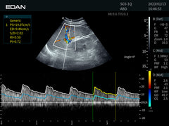 EDAN AX8 Portable Ultrasound