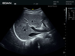 EDAN AX8 Portable Ultrasound