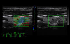 SIUI Apogee 2100 Ultrasound For Sale