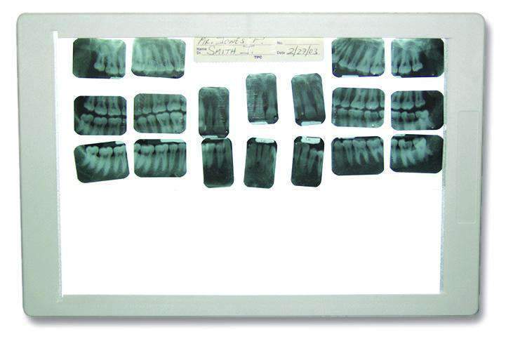TPC Dental XV100 Super Thin X-ray Viewer